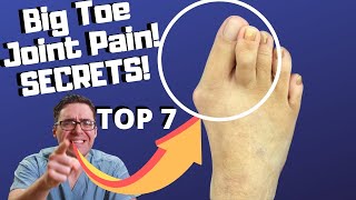 Big Toe Joint Pain Home Treatment Top 7 Relief amp Remedies [upl. by Janicki429]