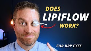 Is Lipiflow Worth It  Advanced Dry Eye Treatment For Meibomian Gland Dysfunction MGD [upl. by Stafani]