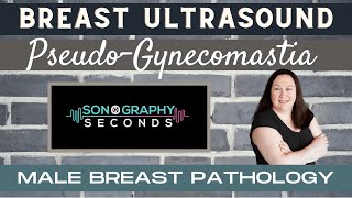 Breast Ultrasound Male Breast Pathology PseudoGynecomastia [upl. by Attebasile]