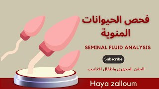 فحصالحيوانات المنويةseminal fluid analysis spermanalysis sperm morphology movement [upl. by Leftwich]