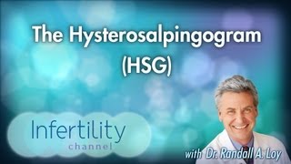 The Hysterosalpingogram HSG [upl. by Enytsuj494]