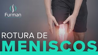 ROTURA DE MENISCO 🦵Dolor de RODILLA Causas  Síntomas  Tratamientos [upl. by Maddox238]