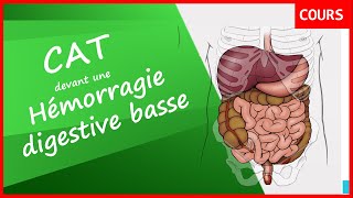 Inquiétant comment gérer une Hémorragie digestive basse 🤔  📝La CAT cours est là 😄  HGElogie [upl. by Oiramej470]