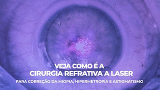 Hipermetropia Miopia Astigmatismo Enfermedades Visuales Problemas Refractivos y LASIK YouTube [upl. by Strohben258]