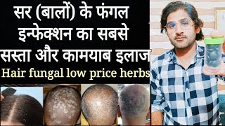 Hair fungal infection best low price herbal treatmentHair loss herbal treatment [upl. by Lory]