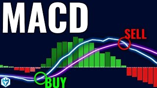 How I Nailed Trading with the MACD Indicator StepbyStep Guide [upl. by Arleyne]