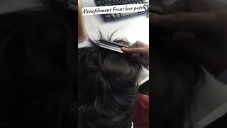 Monofilament Hair Patch  Men Hair Patch  9891001825 shorts menhairpatch hairpatchindelhi [upl. by Thar]