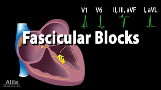 Fascicular Blocks Animation [upl. by Neils]