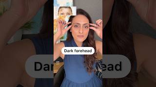 Dark forehead  How to improve  creams to use [upl. by Hcone460]