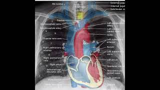 CHEST XRAY ANATOMY [upl. by Semela]