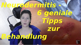 Neurodermitis Gesicht  6 Tipps zur Behandlung [upl. by Atikal951]