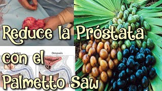 Reduce la Próstata Naturalmente  Propiedades del Saw Palmetto  Como desinflamar la prostata grande [upl. by Suiramad]