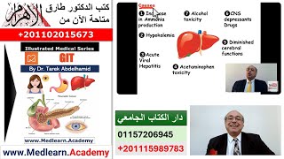 Acute Hepatic Coma internalmedicine cme medicaleducation ecg محاضراتباطنة medical [upl. by Adlez876]