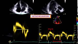 DETERMINANTS OF DIASTOLIC DYSFUNCTION relaxation restoring forces lengthening load [upl. by Haynor]