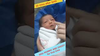 Cute newborn baby next to parents for the first time after birth 😍 viralbaby [upl. by Inoek]