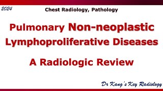 Pulmonary Nonneoplastic lymphoproliferative disease LPD [upl. by Daniala]