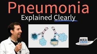 Pneumonia Explained Clearly by MedCramcom [upl. by Nalhsa140]