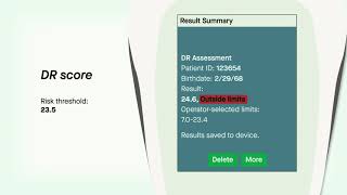 A Superior DR Progression Risk Assessment with the RETeval Device — Mitch Brigell PhD [upl. by Schott587]