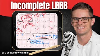 Incomplete Left Bundle Branch Block ILBBB EKG  ECG Lecture [upl. by Curzon]