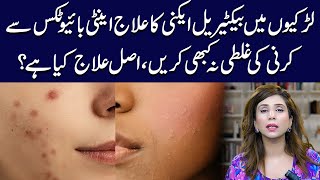 Bacterial Acne Treatment for Girls Top Tips and Tricks  Dr Sahar Chawla [upl. by Mariellen]