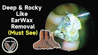 Deep amp Rocky Like EarWax Removal [upl. by Feer]