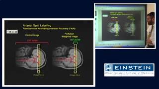 How to read a CT angiogram CTA of the Head and Neck [upl. by Annaeirb]