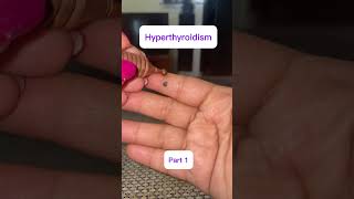 Acupressure point for Hyperthyroidismnepali acupressure shortsvideo [upl. by Avaria]