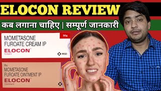 elocon cream use in hindi  elocon ointment use in hindi [upl. by Amarillis]