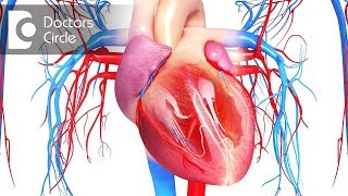 Does recurrennce of fluid post pericardial surgery possible  Dr Durgaprasad Reddy B [upl. by Herson]