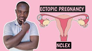 ECTOPIC PREGNANCY for nurses and all NCLEX student [upl. by Ernestus]