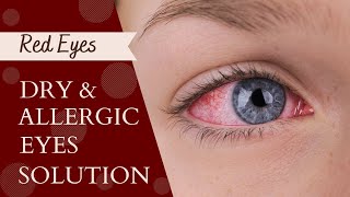 Drops For Red Eyes Pain  Dry Eyes Treatment [upl. by Rheinlander3]