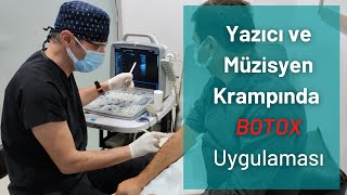 Distoni Tedavisinde Botox Uygulaması I Yazıcı Müzisyen Kramplarında Tedavi [upl. by Dadinirt]