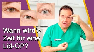 AugenlidOP – Ab wann ist OP sinnvoll Gibt es Alternativen ohne OP Dr Günther Düsseldorf [upl. by Connolly]