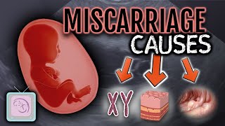 Dr Morris Ultimate Guide to Recurrent Miscarriage Testing [upl. by Pollard812]