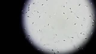 Sperm wet preparation under microscope viewed by 40× objective [upl. by Hare265]