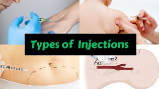 Types of Injections nursing mbbs medical injection intramuscularinjection intravenousinjection [upl. by Zielsdorf]