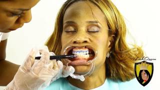 TEETH WHITENING TUTORIAL How to Start a TEETH Whitening Business amp Is Teeth Whitening Legal [upl. by Lacie]