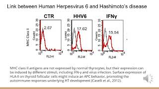 Hashimoto’s Disease Immunology [upl. by Bertrando]