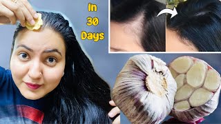 30 Days Hairline Regrowth Challenge  Receding Hairline Bald Patches हल्के बालों को करें घना 100 [upl. by Marlo]