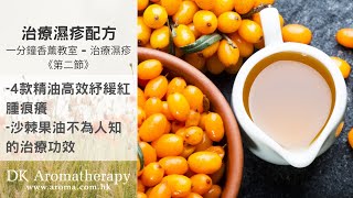 香薰治療顧問私藏治療濕疹配方大公開！｜香薰精油紓緩濕疹配方  第二節｜一分鐘香薰教室 ｜DK Aromatherapy [upl. by Hannon]