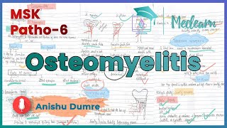 MSK Patho6  Osteomyelitis  Pathophysiology Morphology Tuberculous Osteomyelitis MEDLEARN [upl. by Sreip979]