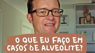 O que eu faço em casos de alveolite  Prof Mauricio Volkweis [upl. by Cuda936]