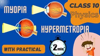 Myopia amp Hypermetropia II Reason II Correction  Practical [upl. by Mellar683]