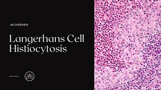 What is Langerhans Cell Histiocytosis [upl. by Risser]