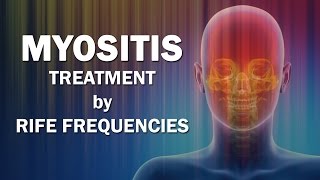 Myositis  RIFE Frequencies Treatment  Energy amp Quantum Medicine with Bioresonance [upl. by Nehtan269]