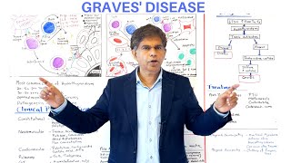 GRAVES DISEASE  AN OVERVIEW  By Pramil Cheriyath MD [upl. by Lateehs58]