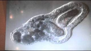 Amoeba eats two paramecia Amoebas lunch [upl. by Aikemot890]