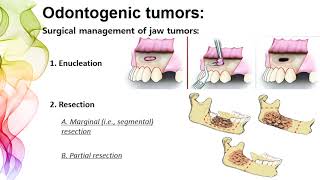 Odontogenic Tumors section 1  DR NOOR SAHBAN FOURTH GRADE [upl. by Nyad619]