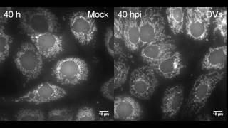 Dengue Virus Infection Induces Mitochondrial Elongation [upl. by Eyma]