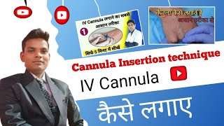 IV Cannula Insertion how To Insert IV Cannula doctor mbbs youtubevideo ivcannula neet viral [upl. by Nelon274]